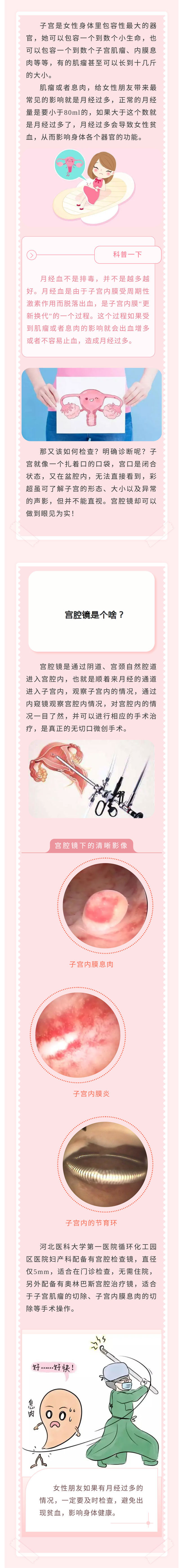 月經(jīng)量增多！怎么回事？——小小“宮腔鏡”，一探究竟！.jpg
