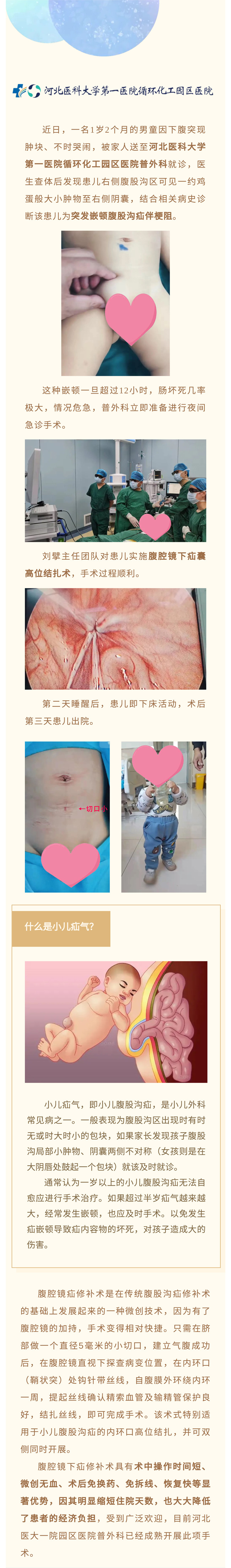 腹腔鏡微創手術治療小兒疝氣——切口5毫米！手術→活動，僅半天！-1.jpg