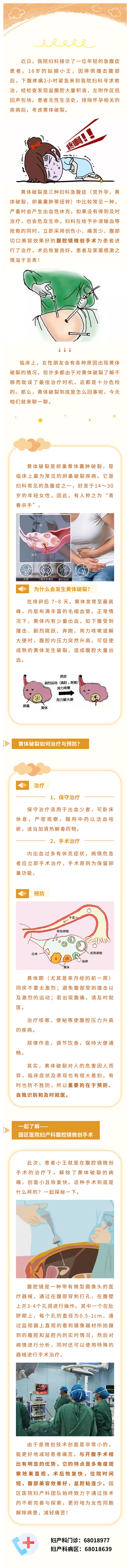 少女腹痛難忍，竟是黃體破裂！腹腔鏡手術助其轉危為安-1.jpg